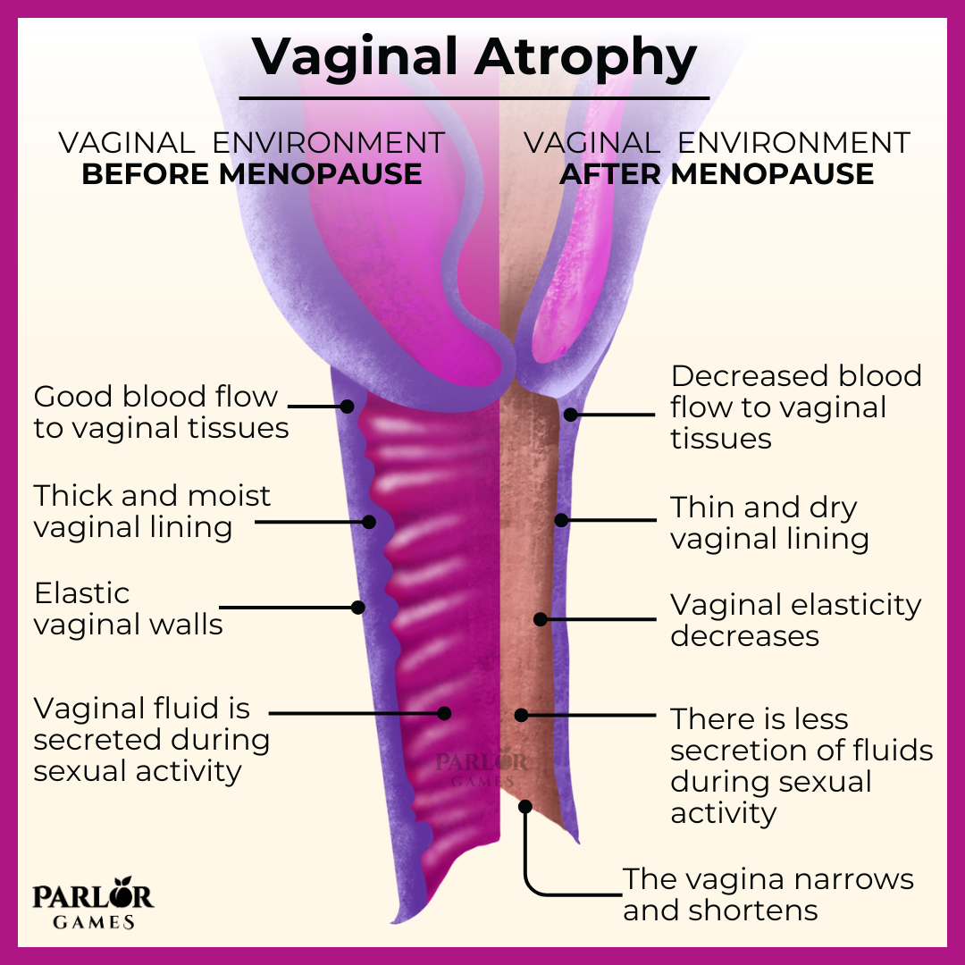 Vaginal Atrophy Experts Review: Best 5 Vaginal Moisturizers To Treat